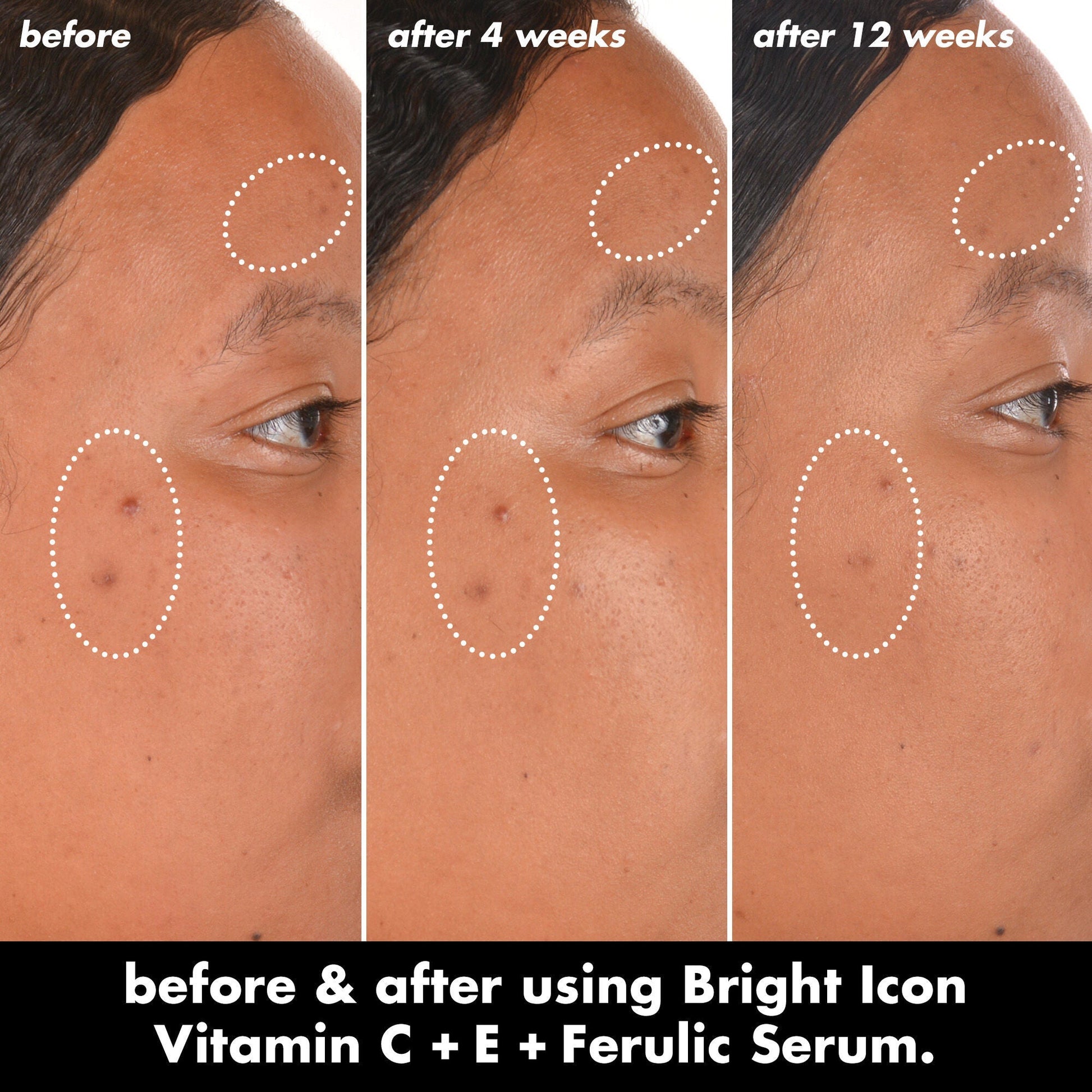 bright-icon-vitamin-c-e-ferulic-serum-g5 0226_EDU_BrightIconVitC_BA_Chanel_TRIPTYCH_c58f2fc8-209d-414f-9ba3-666a07a94887.jpg