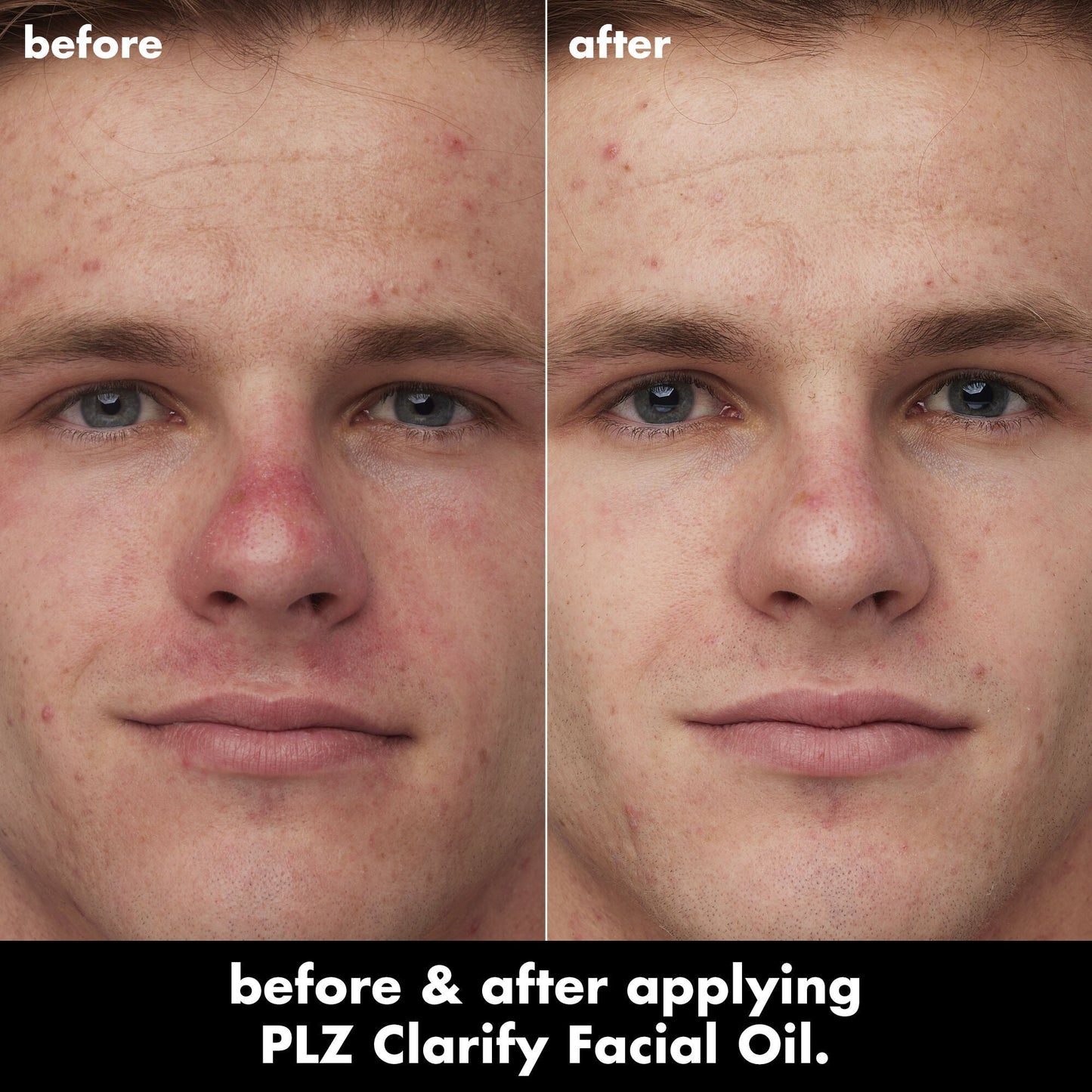 plz-clarify-facial-oil-m2 0326_EDU_PlzClarify_BA_Caleb.jpg