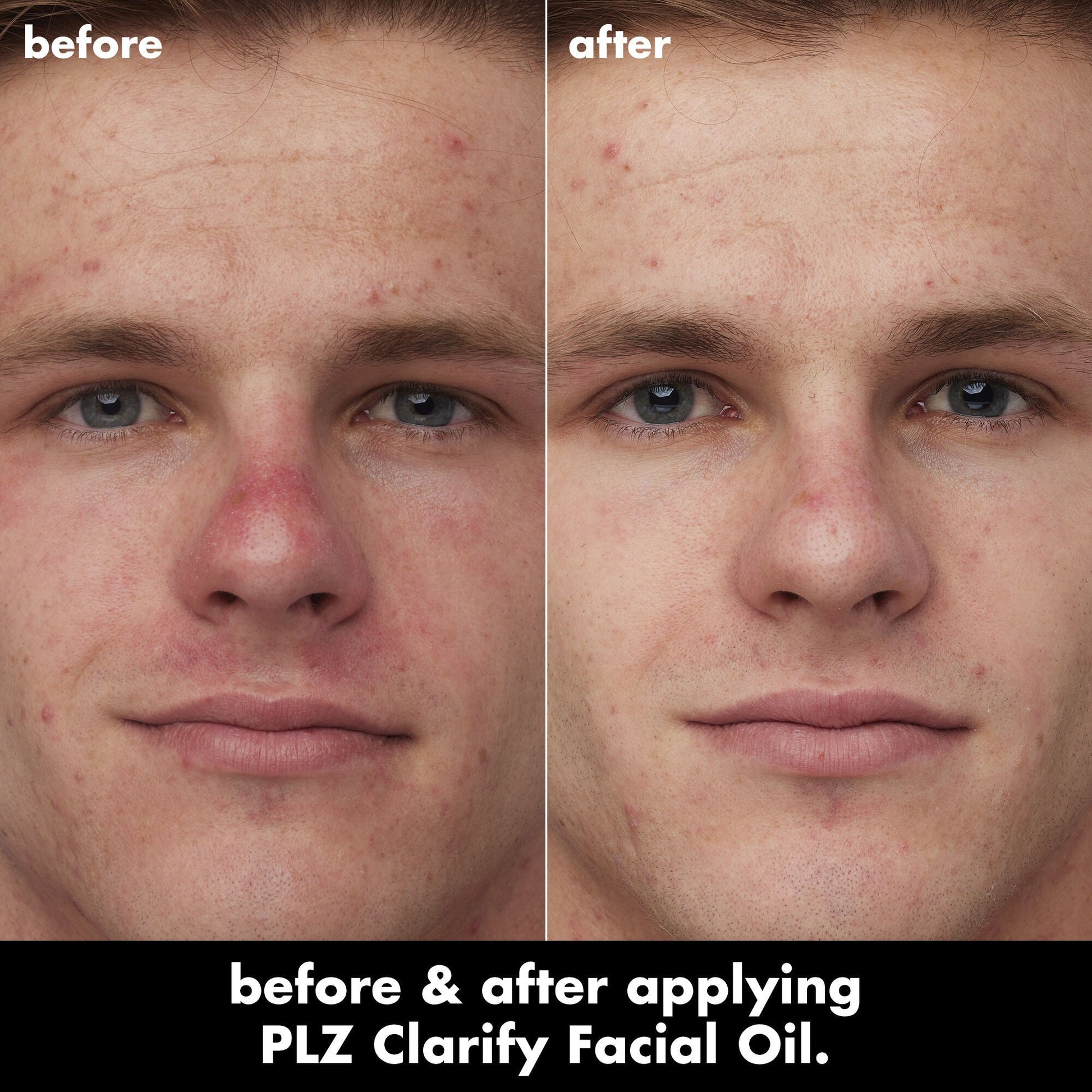 plz-clarify-facial-oil-m2 0326_EDU_PlzClarify_BA_Caleb.jpg