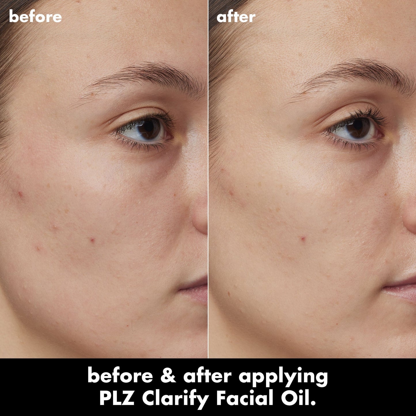 plz-clarify-facial-oil-m2 0326_EDU_PlzClarify_BA_Kelly.jpg