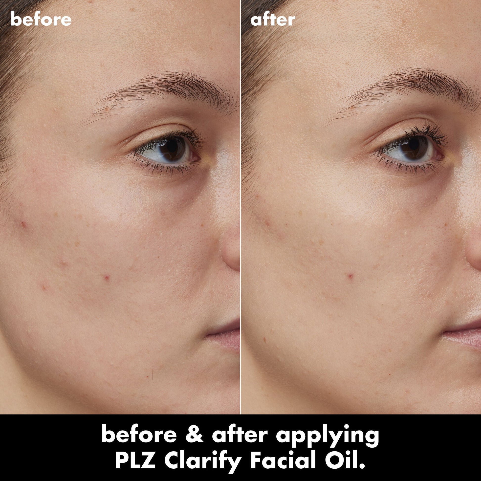 plz-clarify-facial-oil-m2 0326_EDU_PlzClarify_BA_Kelly.jpg
