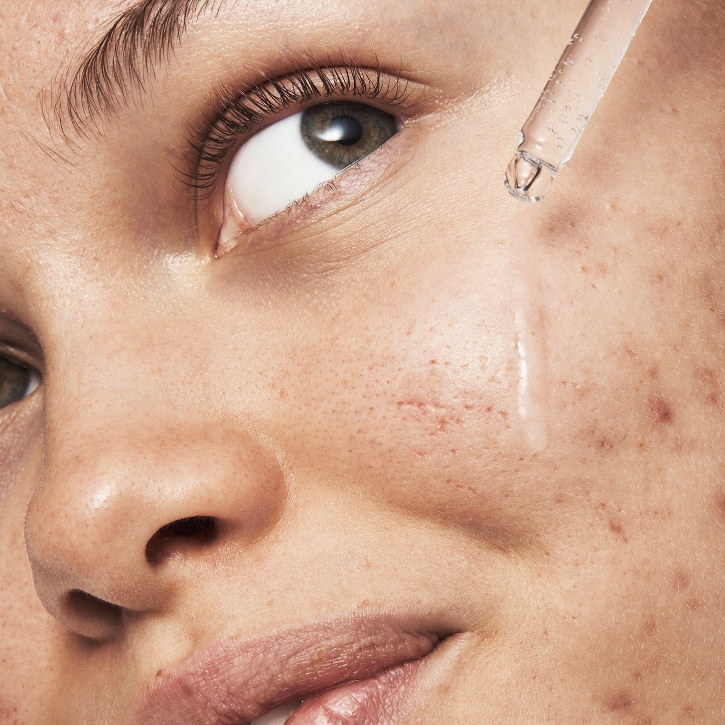 blemish-breakthrough-triple-acid-resurfacing-serum-w4 121321_Marley-Acne-Regimen_0254_FINAL_IGF.jpg