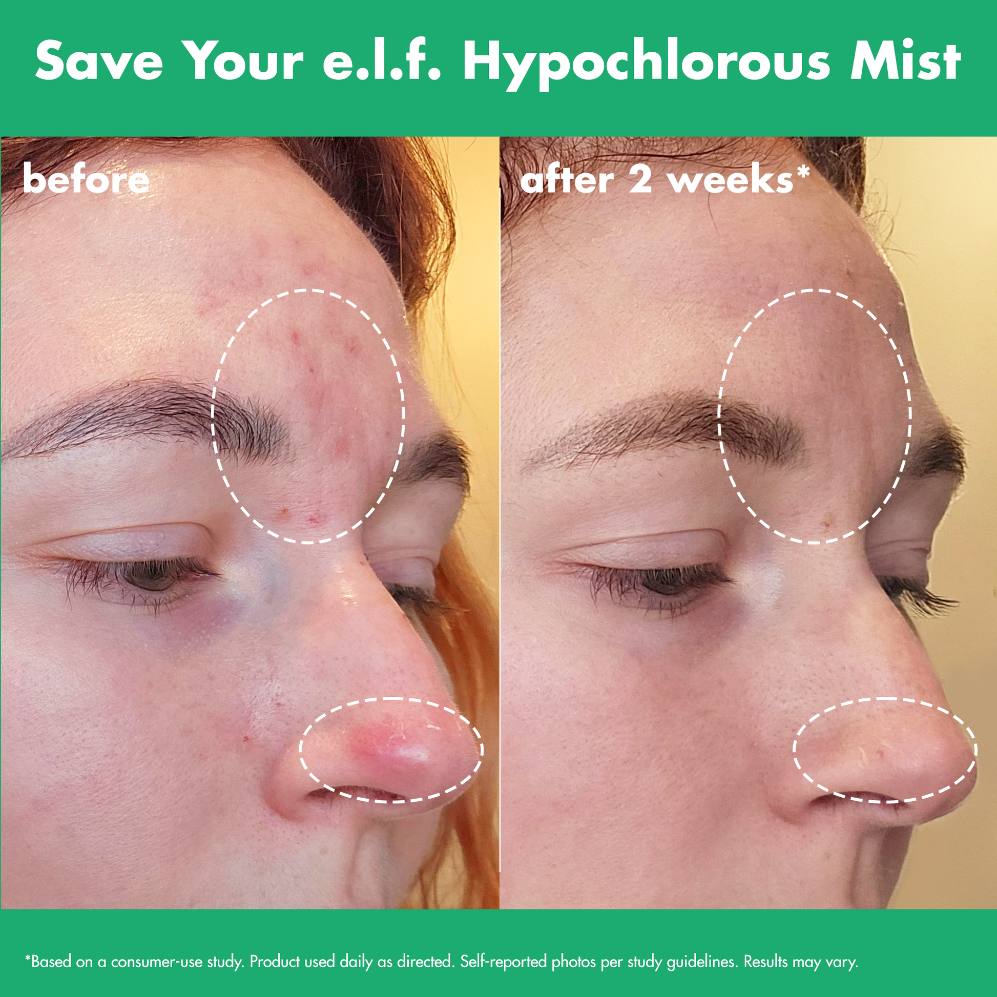 save-your-e-l-f-hypochlorous-mist-z5 FA26_EDUCATION_SAVEYOURELF_USAGE_BA1_WITHOUT_CLAIMS.png