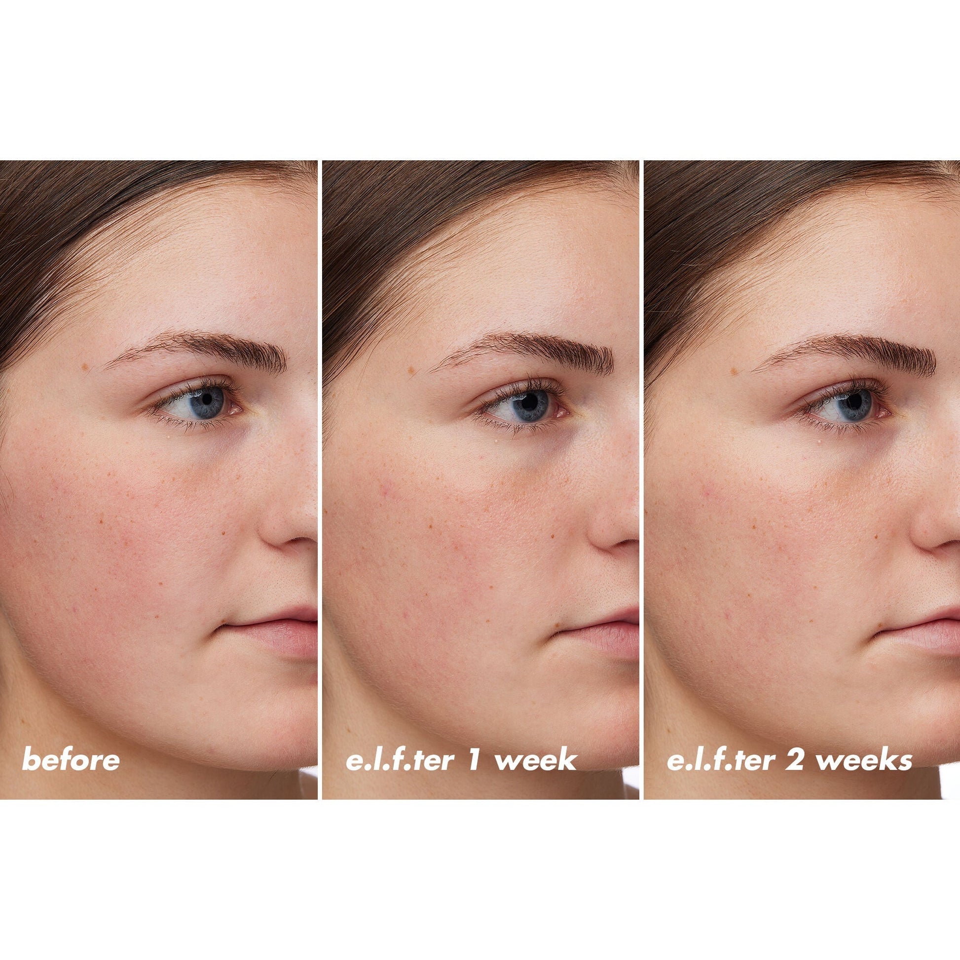 holy-hydration-barrier-goals-cream-regular-j3 XX26_EDUCATION_HH-BarrierGoals_B_A_Zoe_TRYPTICH_74c905bd-67bd-4b91-b633-2b01a8905cb8.jpg